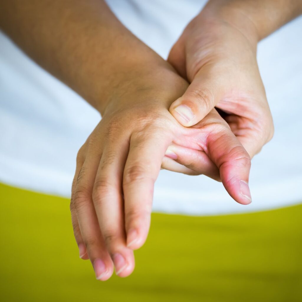 A person holding and pressing their swollen, reddened thumb and hand, possibly indicating pain or injury, with a blurred background of white and yellow.